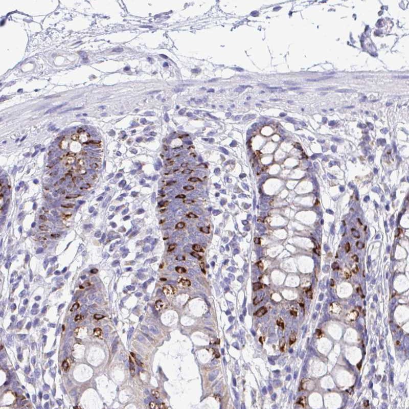 Atlas Antibodies Anti-NLRP8 Antibody