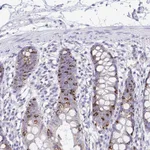 Atlas Antibodies Anti-NLRP8 Antibody