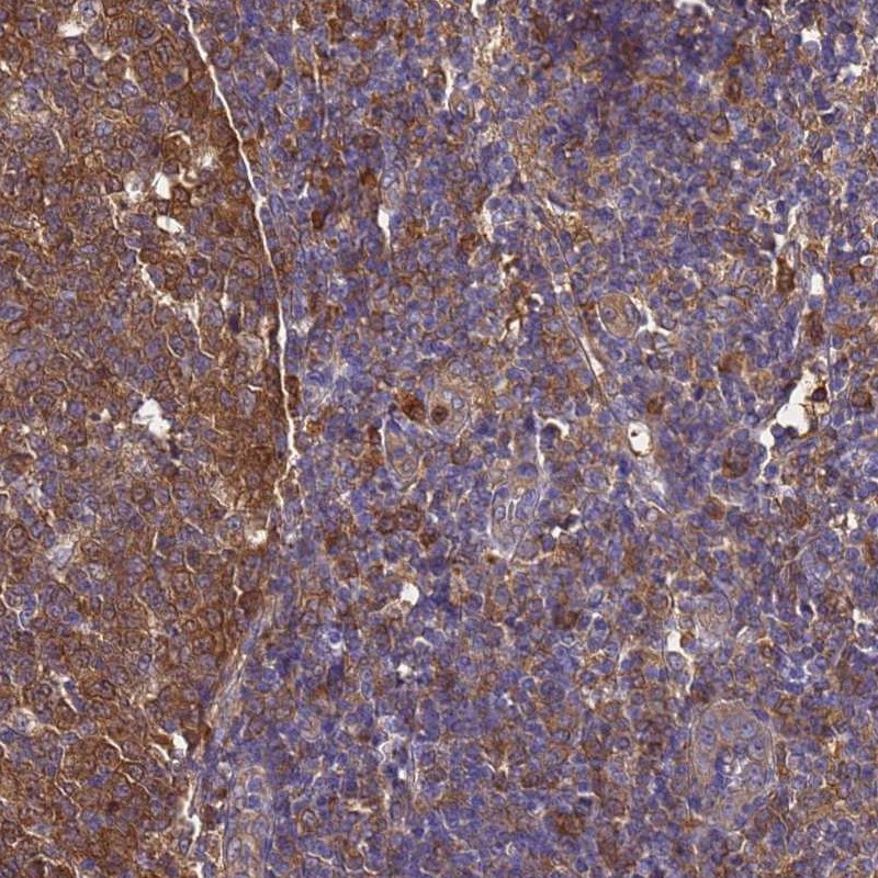 Atlas Antibodies Anti-NME1 Antibody