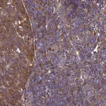 Atlas Antibodies Anti-NME1 Antibody