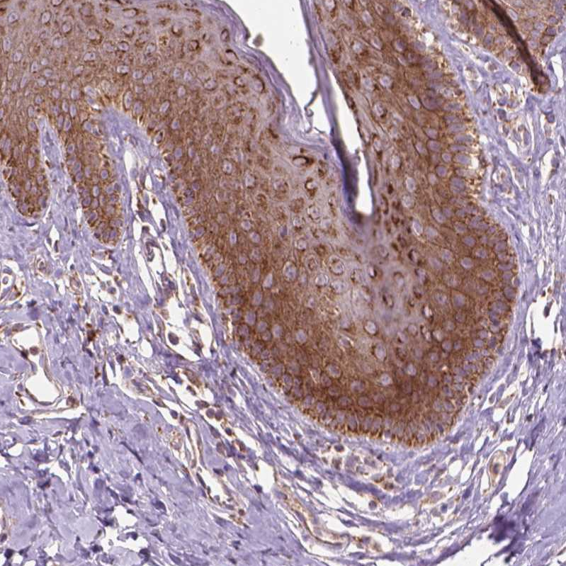 Atlas Antibodies Anti-NLRX1 Antibody