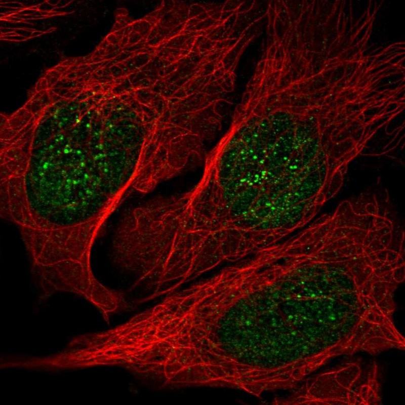Atlas Antibodies Anti-NME3 Antibody