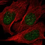 Atlas Antibodies Anti-NME3 Antibody