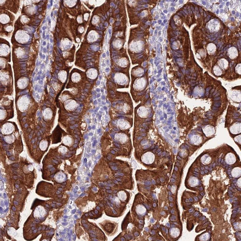 Atlas Antibodies Anti-NLRP6 Antibody