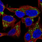 Atlas Antibodies Anti-NME4 Antibody