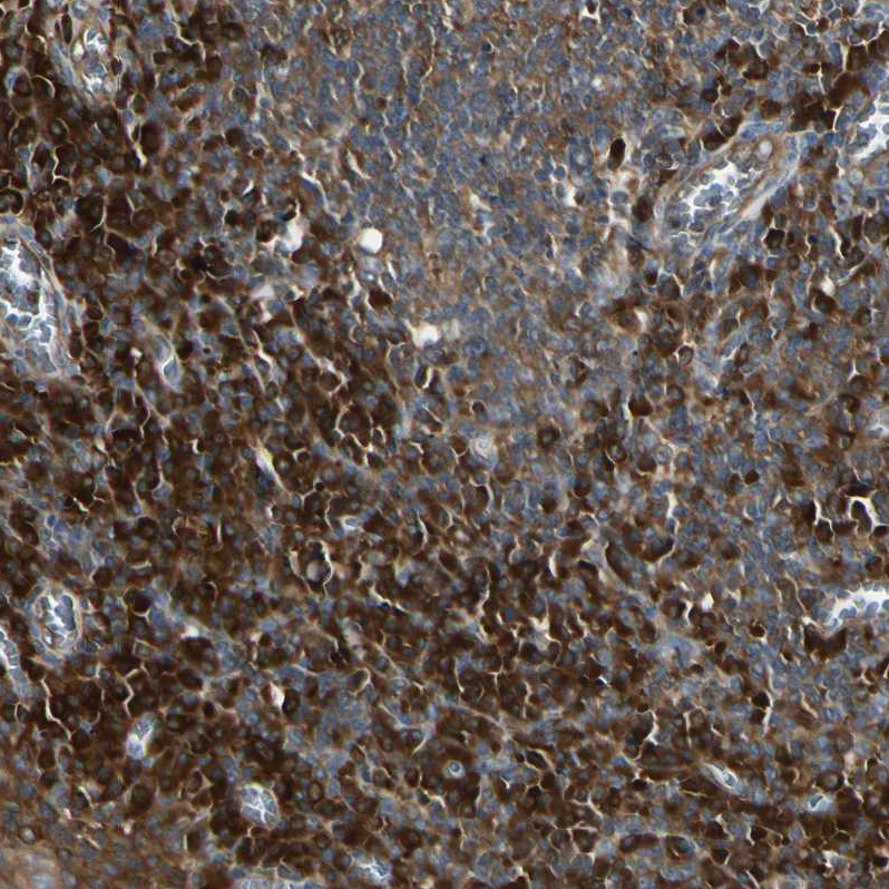 Atlas Antibodies Anti-NME1 Antibody