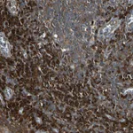 Atlas Antibodies Anti-NME1 Antibody