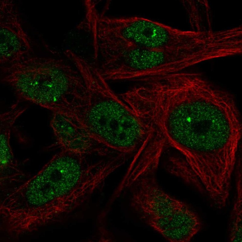 Atlas Antibodies Anti-NME5 Antibody