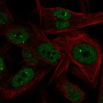 Atlas Antibodies Anti-NME5 Antibody