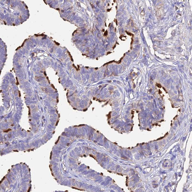 Atlas Antibodies Anti-NME5 Antibody