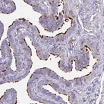 Atlas Antibodies Anti-NME5 Antibody