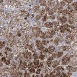 Atlas Antibodies Anti-NME7 Antibody