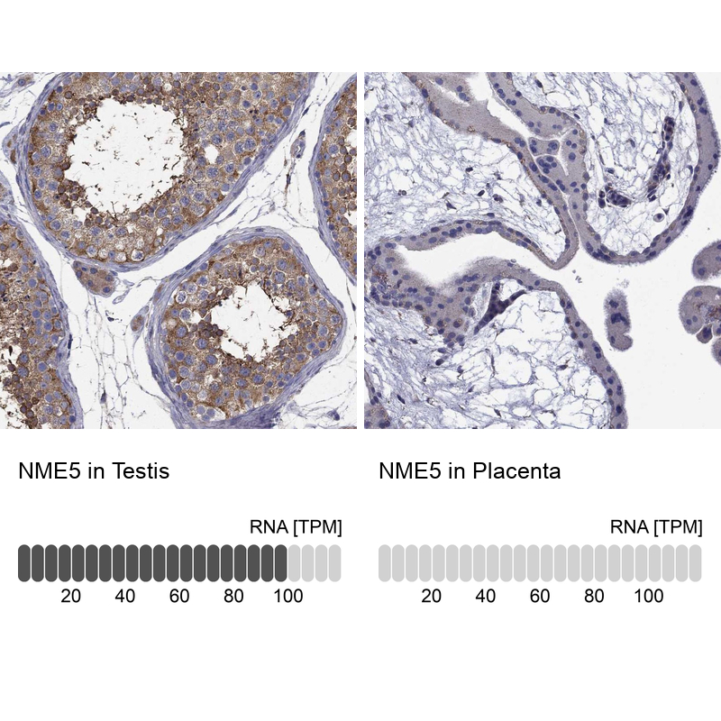Atlas Antibodies Anti-NME5 Antibody