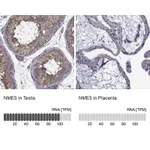 Atlas Antibodies Anti-NME5 Antibody