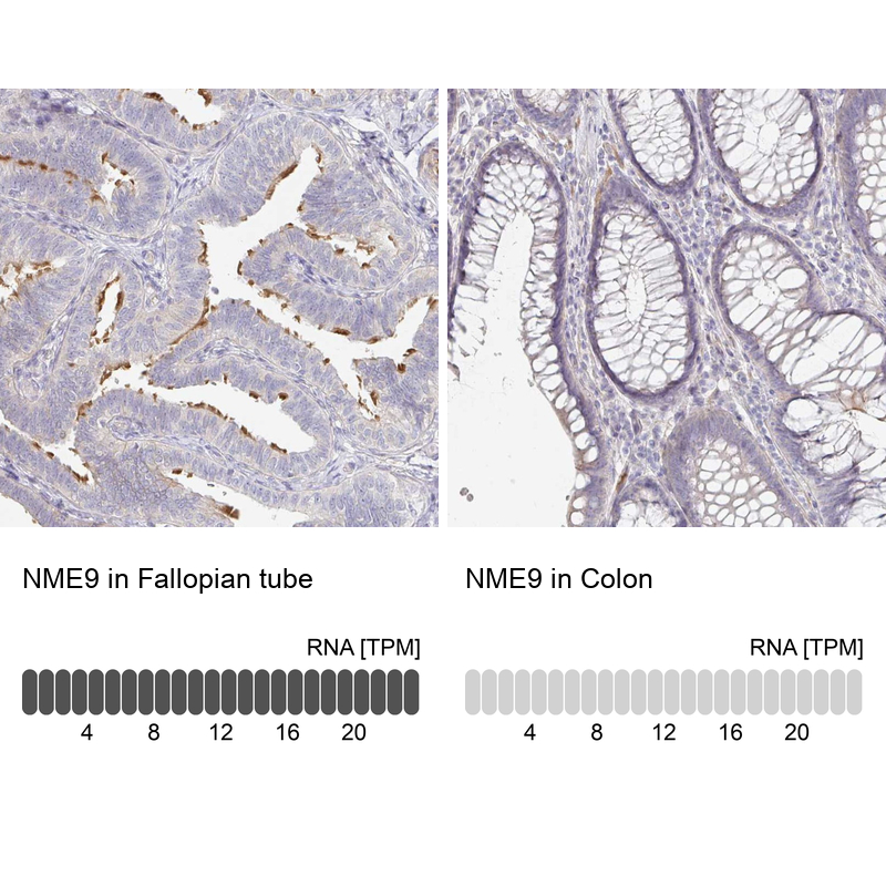 Atlas Antibodies Anti-NME9 Antibody