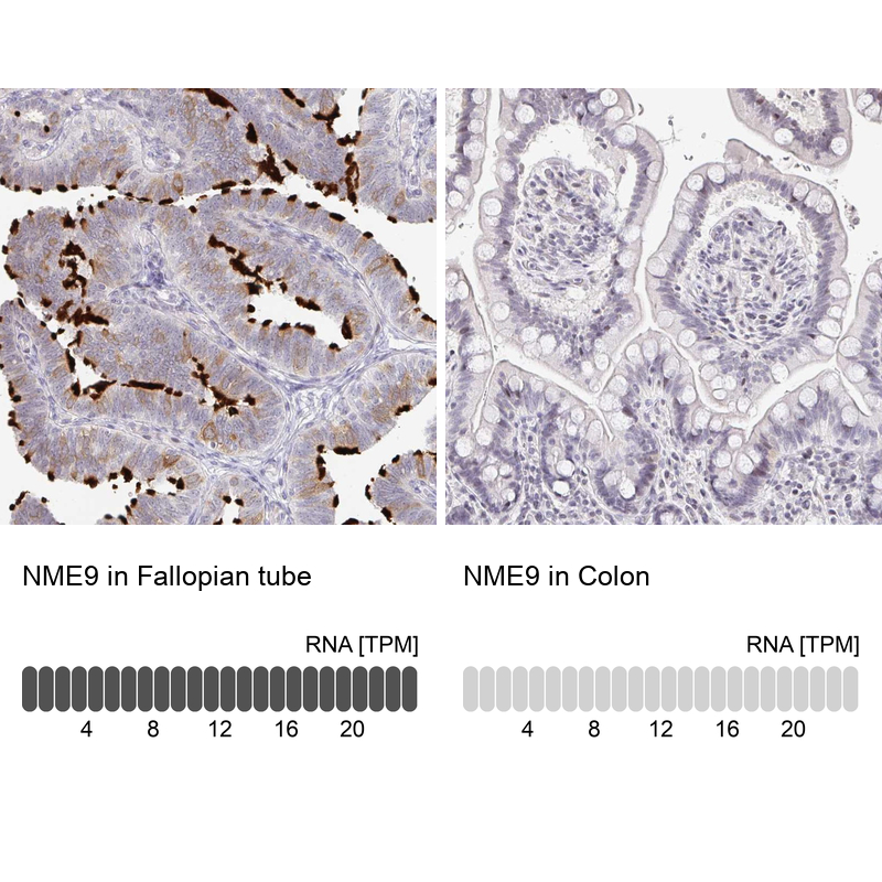 Atlas Antibodies Anti-NME9 Antibody
