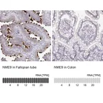 Atlas Antibodies Anti-NME9 Antibody