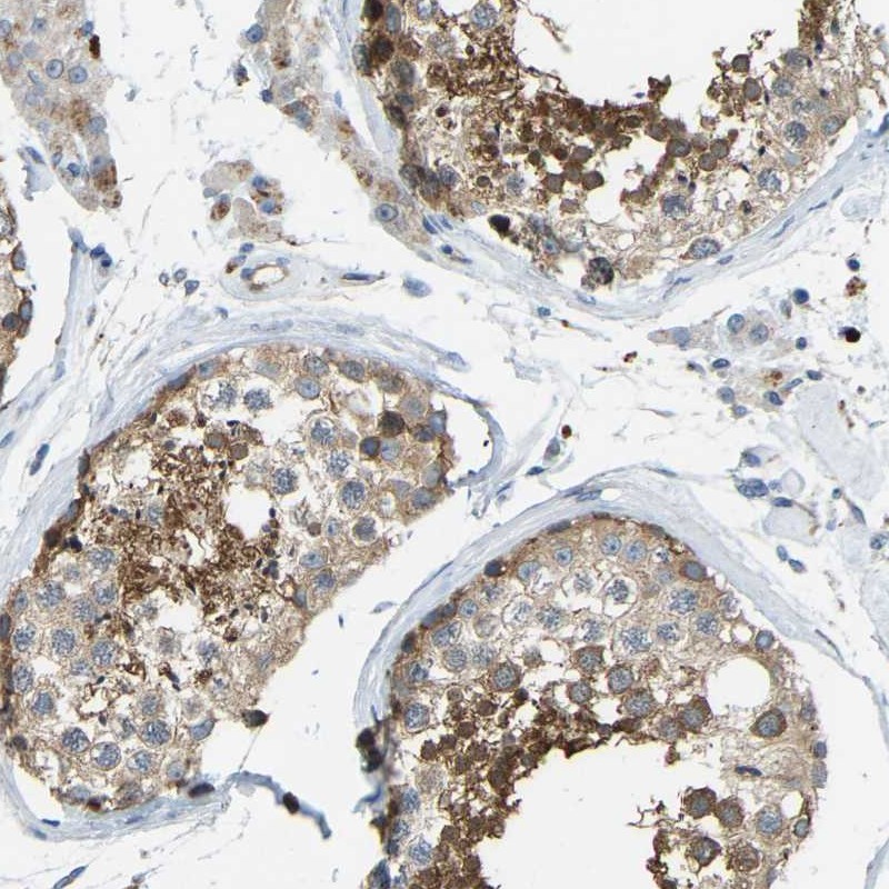 Atlas Antibodies Anti-NME8 Antibody
