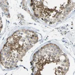 Atlas Antibodies Anti-NME8 Antibody