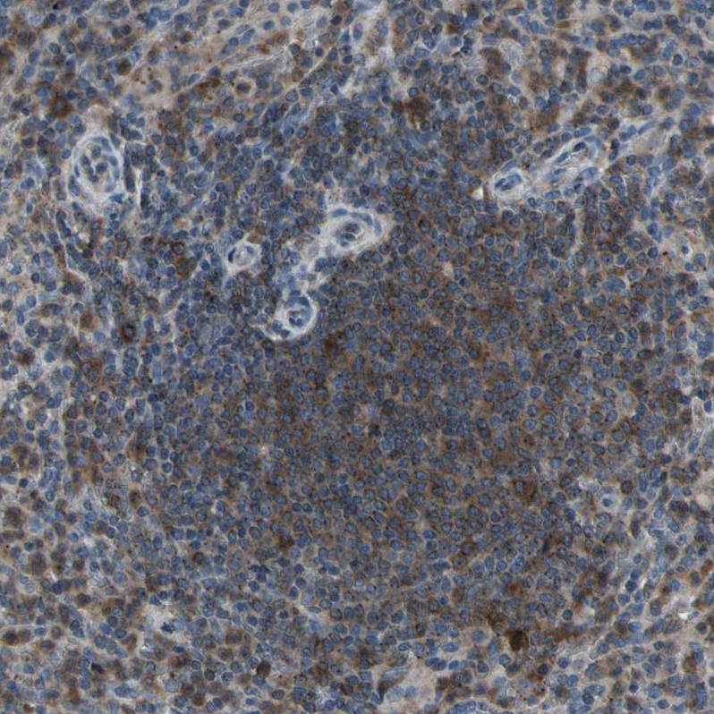 Atlas Antibodies Anti-NMI Antibody