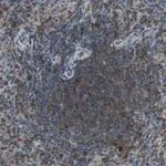 Atlas Antibodies Anti-NMI Antibody