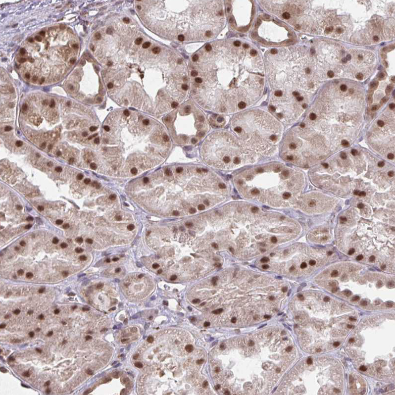Atlas Antibodies Anti-NMNAT1 Antibody