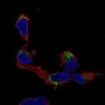 Atlas Antibodies Anti-NMNAT2 Antibody