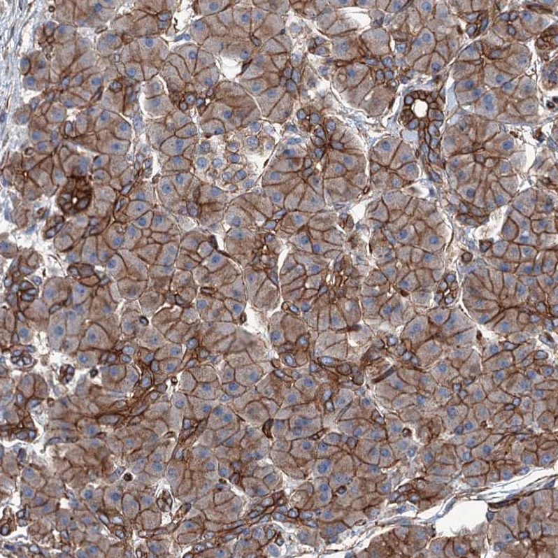 Atlas Antibodies Anti-NMRAL1 Antibody