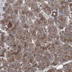 Atlas Antibodies Anti-NMRAL1 Antibody