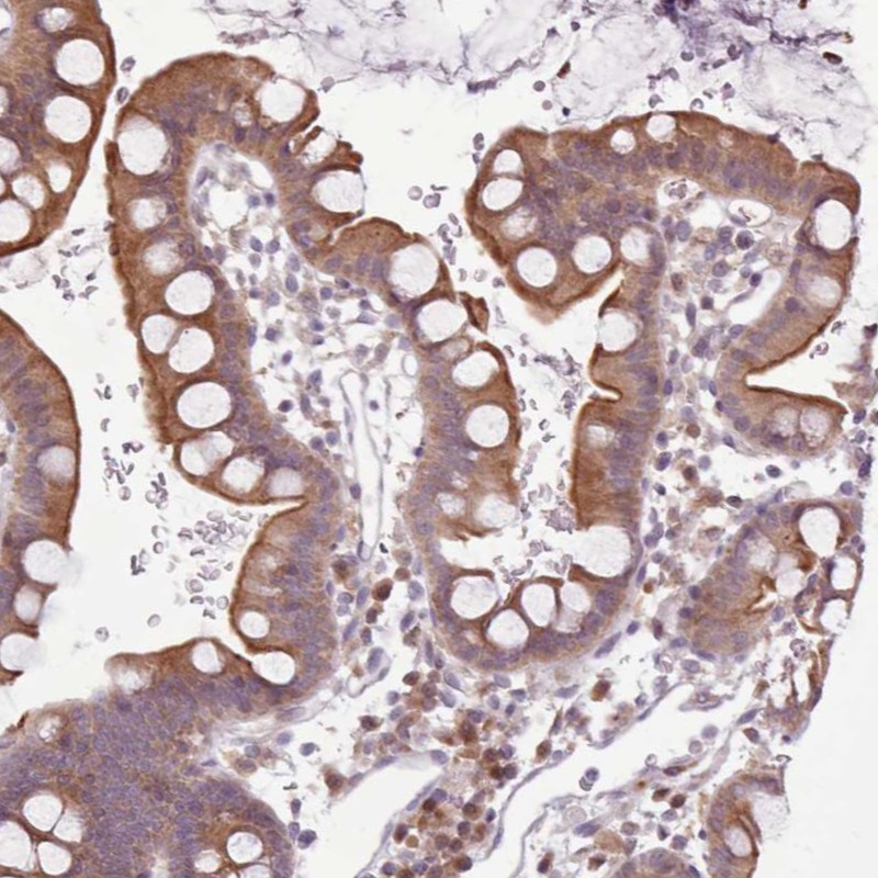 Atlas Antibodies Anti-NMRK1 Antibody
