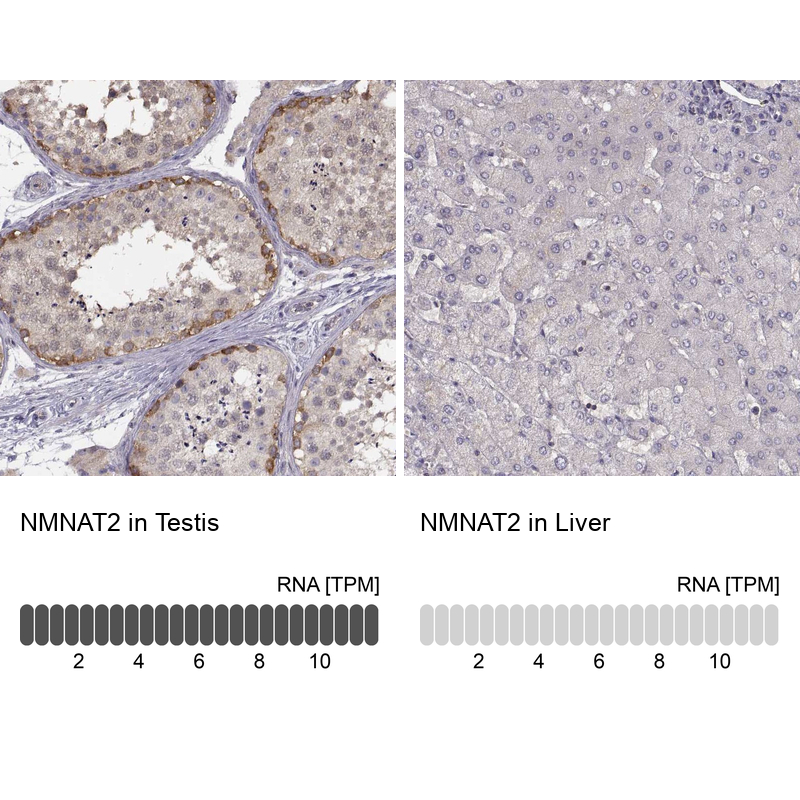 Atlas Antibodies Anti-NMNAT2 Antibody