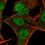 Atlas Antibodies Anti-NMRK2 Antibody