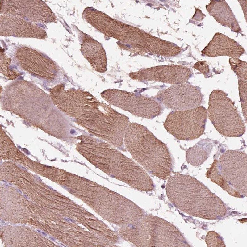 Atlas Antibodies Anti-NMRK2 Antibody