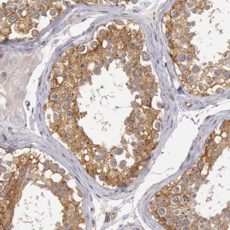 Atlas Antibodies Anti-NMT2 Antibody