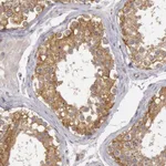 Atlas Antibodies Anti-NMT2 Antibody