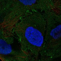 Atlas Antibodies Anti-NMUR2 Antibody