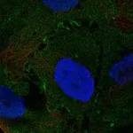 Atlas Antibodies Anti-NMUR2 Antibody