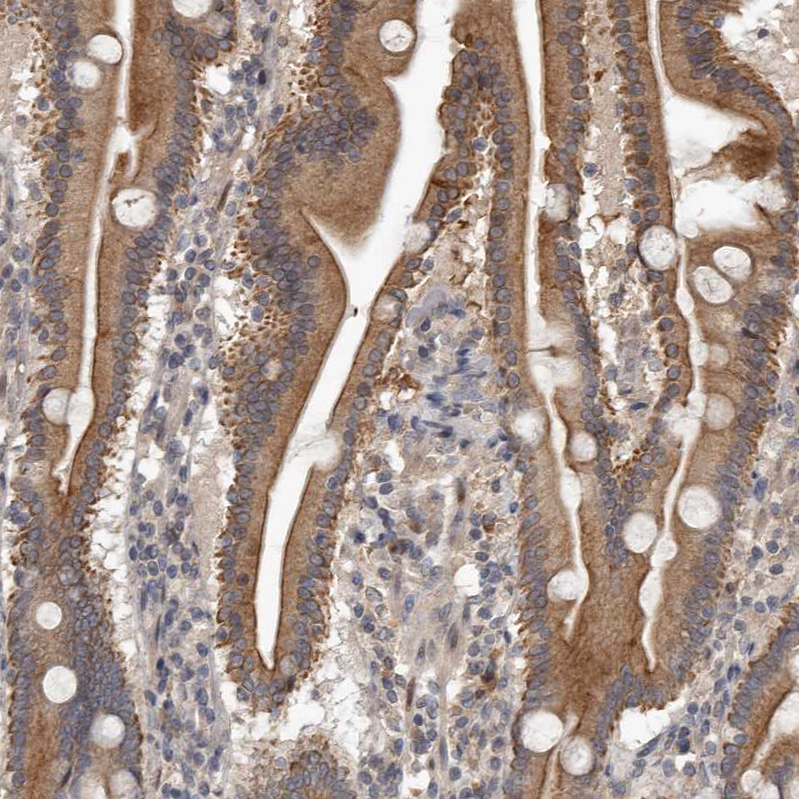 Atlas Antibodies Anti-NMUR1 Antibody