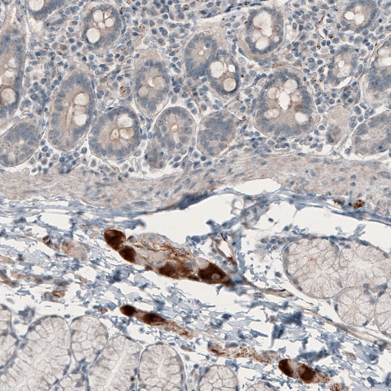 Atlas Antibodies Anti-NMU Antibody