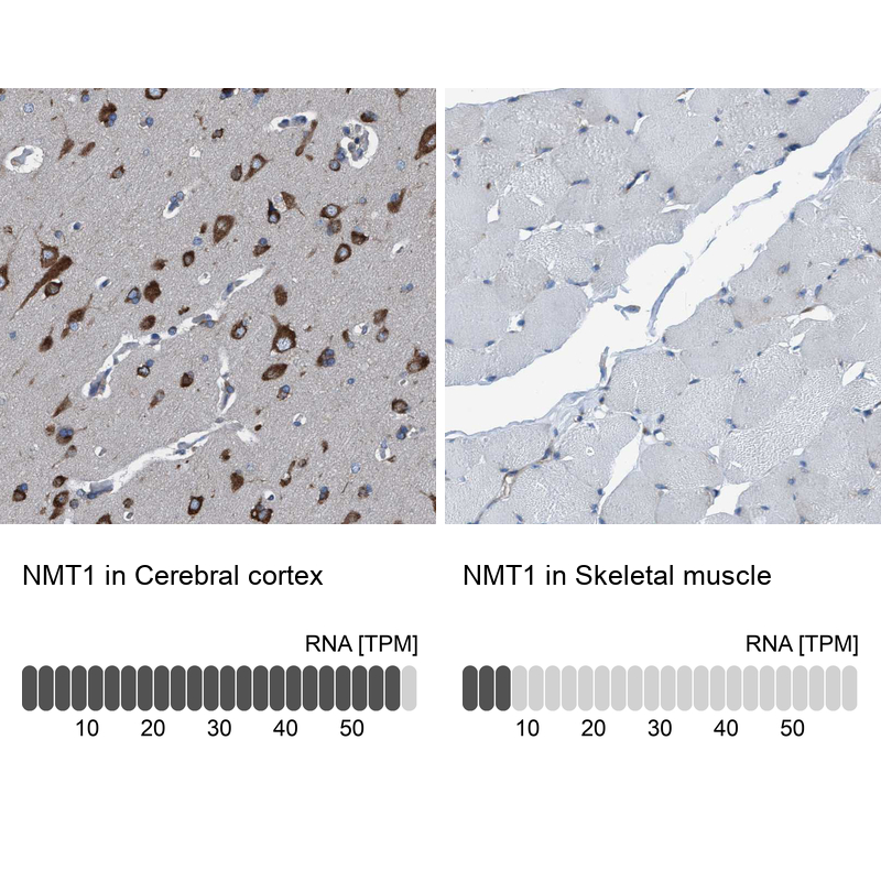 Atlas Antibodies Anti-NMT1 Antibody