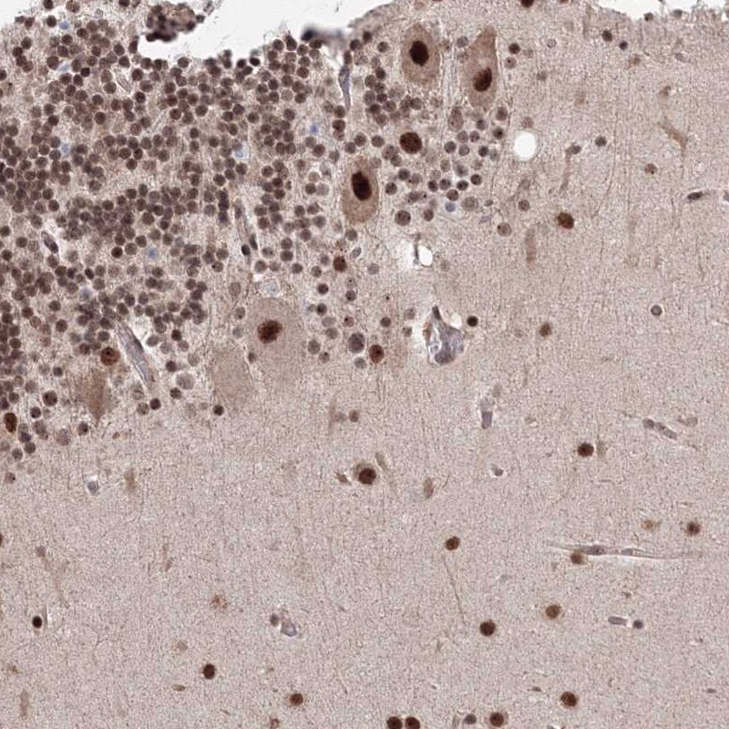 Atlas Antibodies Anti-NOA1 Antibody