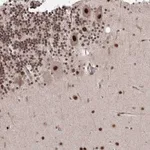 Atlas Antibodies Anti-NOA1 Antibody