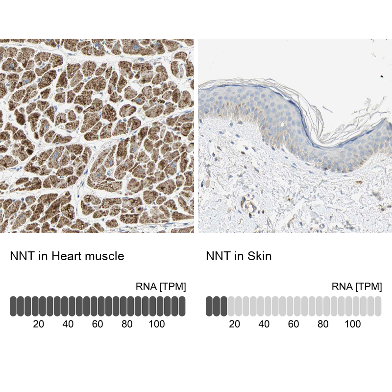 Atlas Antibodies Anti-NNT Antibody