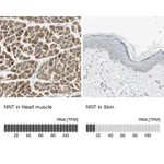 Atlas Antibodies Anti-NNT Antibody