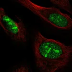 Atlas Antibodies Anti-NOC3L Antibody