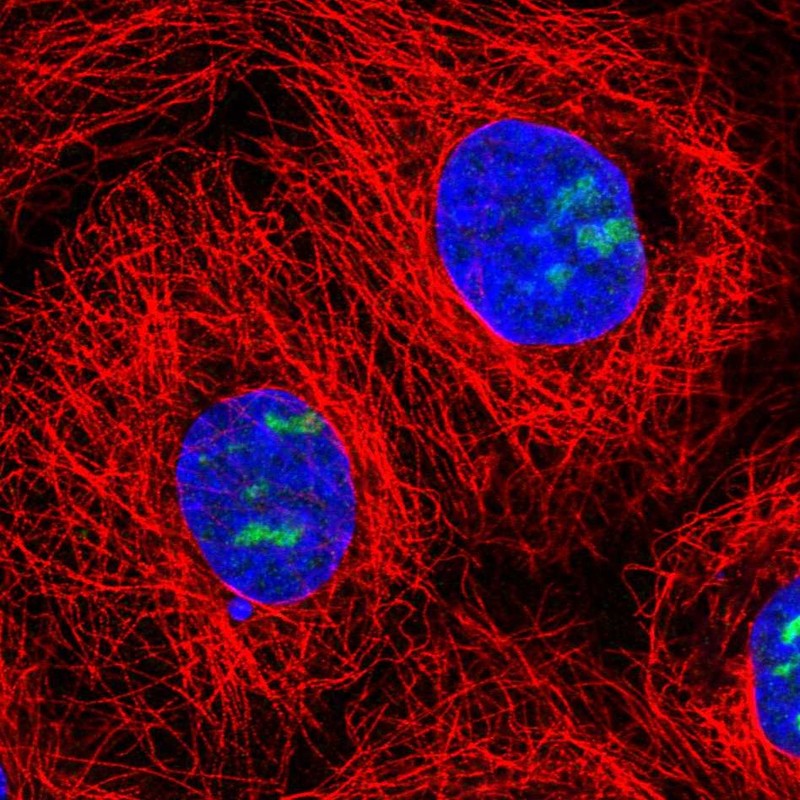 Atlas Antibodies Anti-NOC3L Antibody