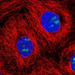 Atlas Antibodies Anti-NOC3L Antibody