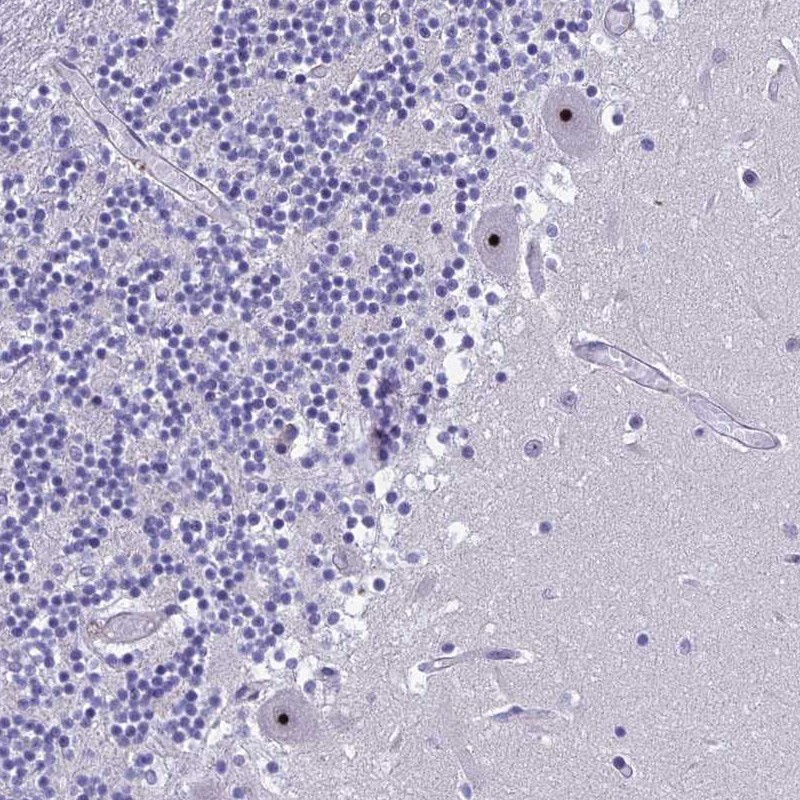 Atlas Antibodies Anti-NOC2L Antibody