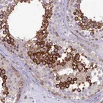 Atlas Antibodies Anti-NODAL Antibody