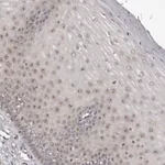 Atlas Antibodies Anti-NOL12 Antibody